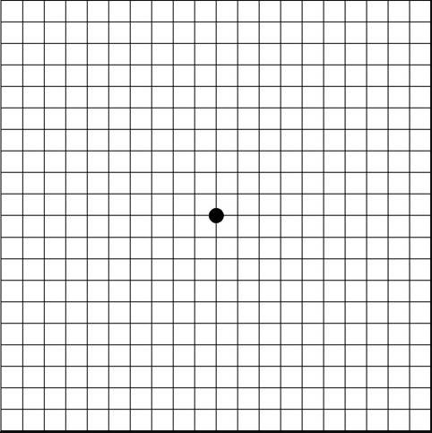 Itt ellenőrizheti látását