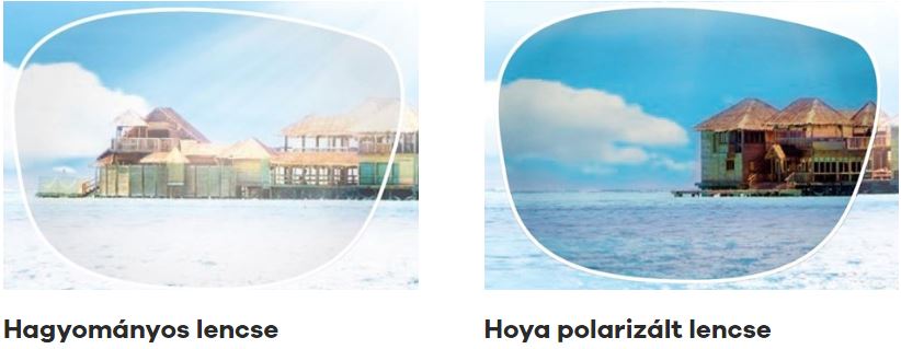 polarizált lencse